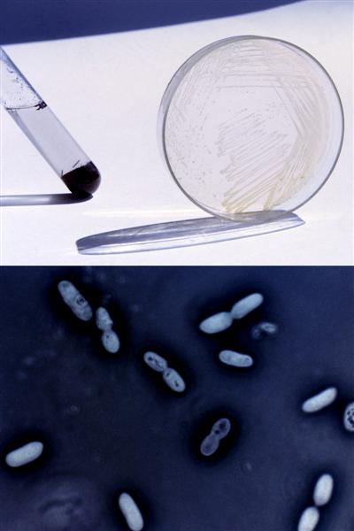 Cultivo y microfotografía de la bacteria azotobacter