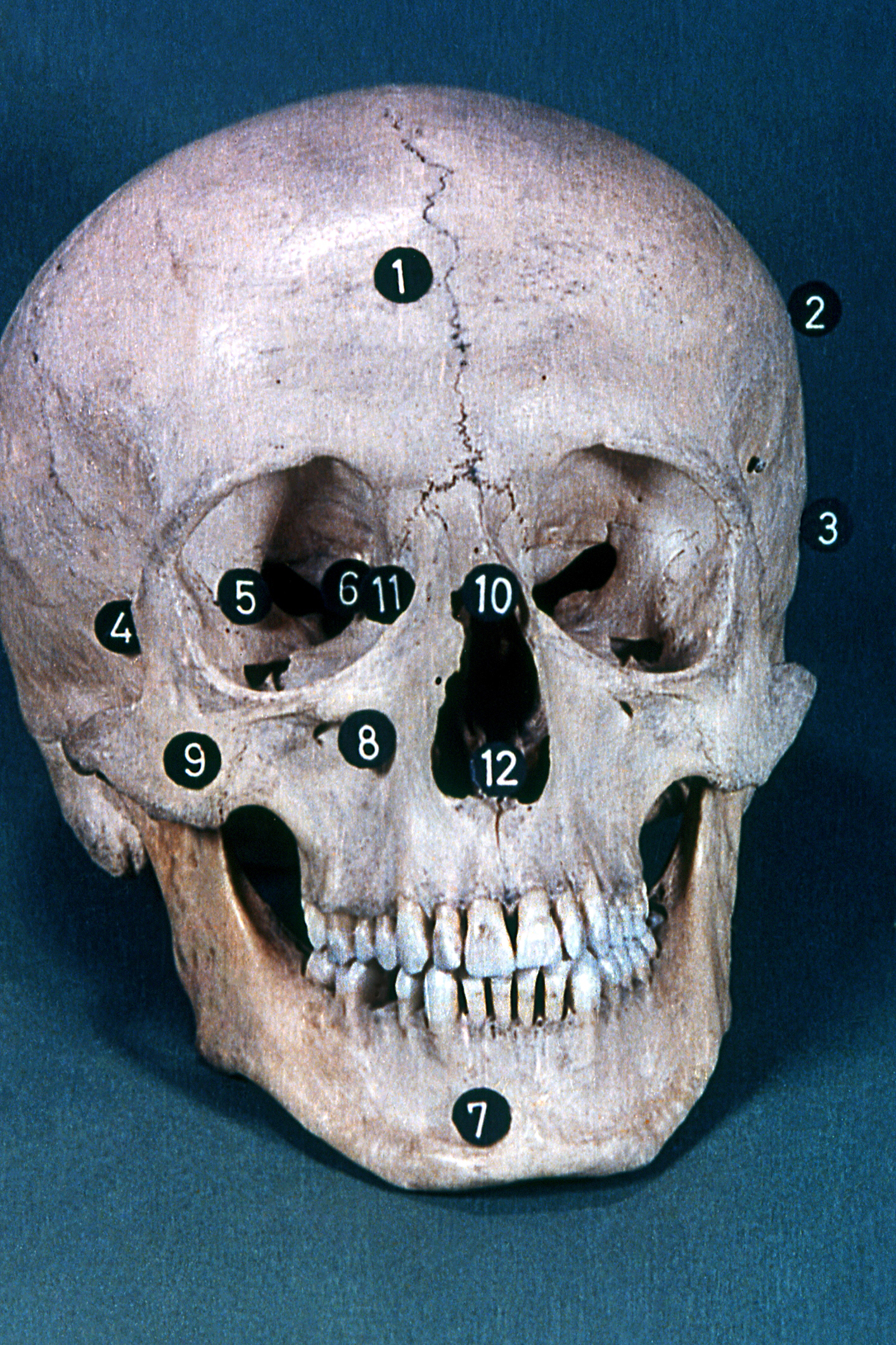 Esqueleto de la cabeza visto de frente
