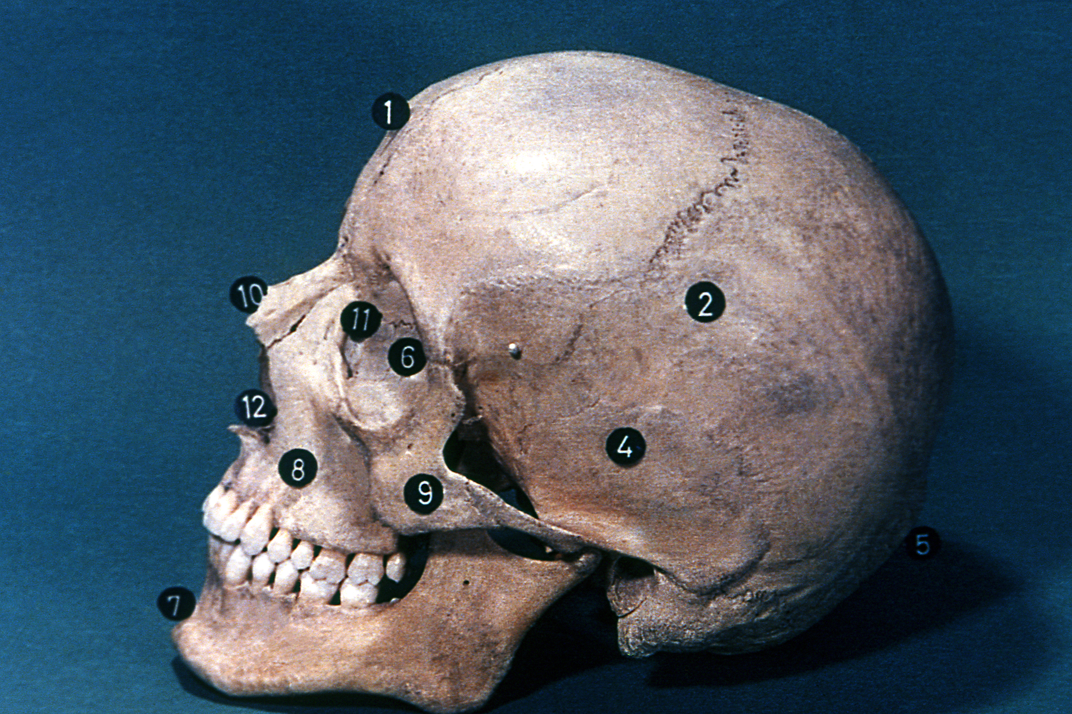 Esqueleto de la cabeza, visión lateral