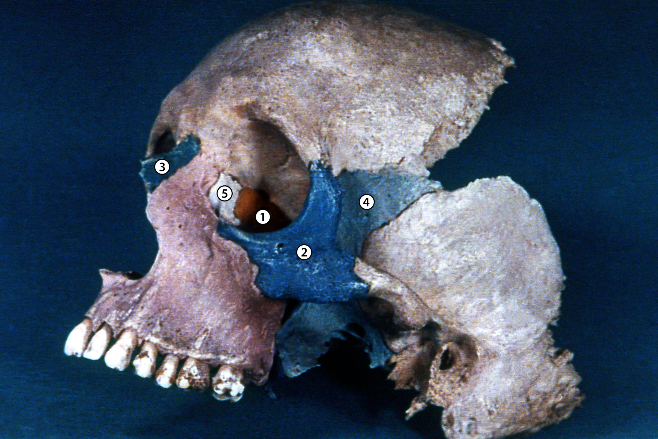 Huesos del esplacnocráneo