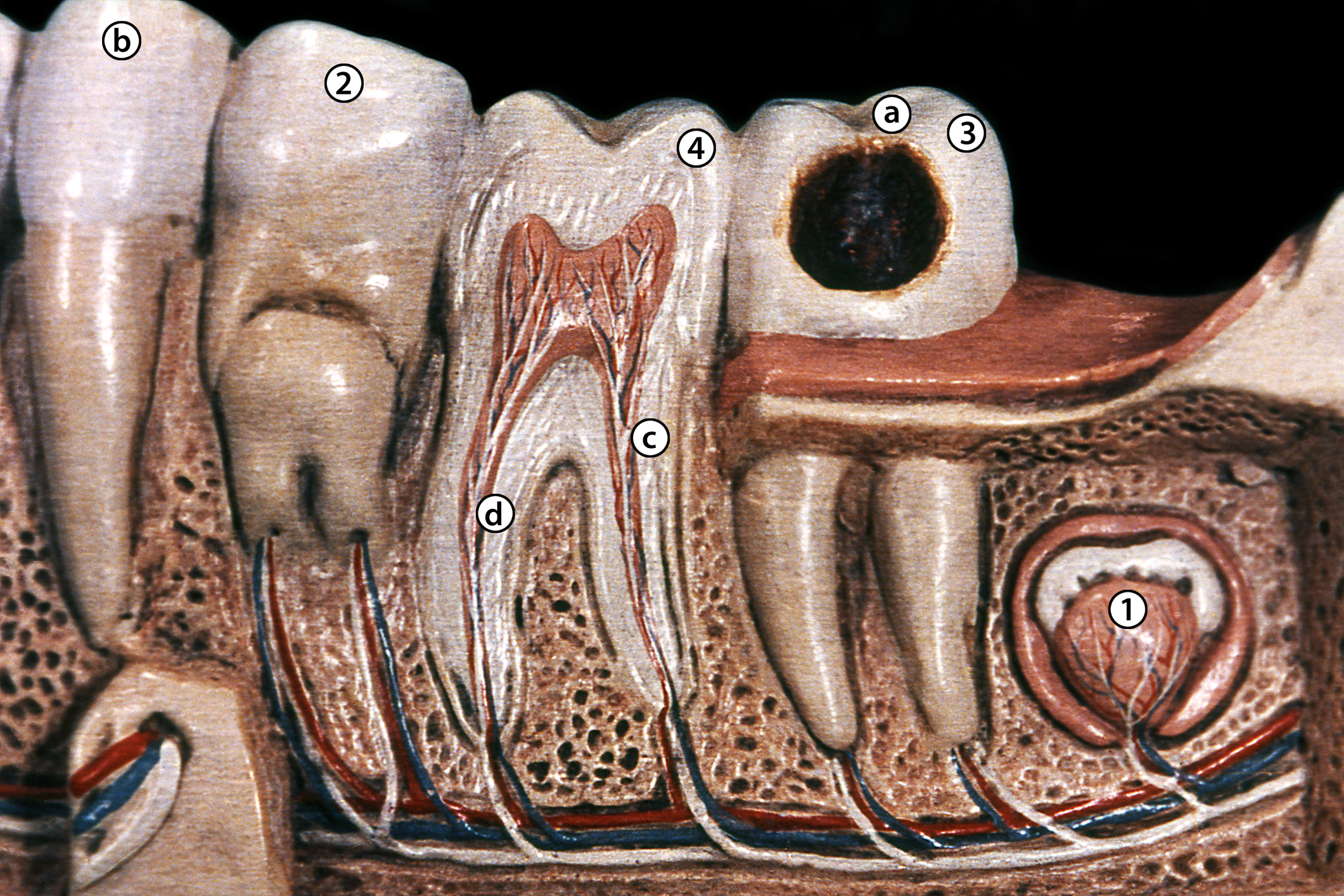 Moldura en yeso de la mandíbula inferior