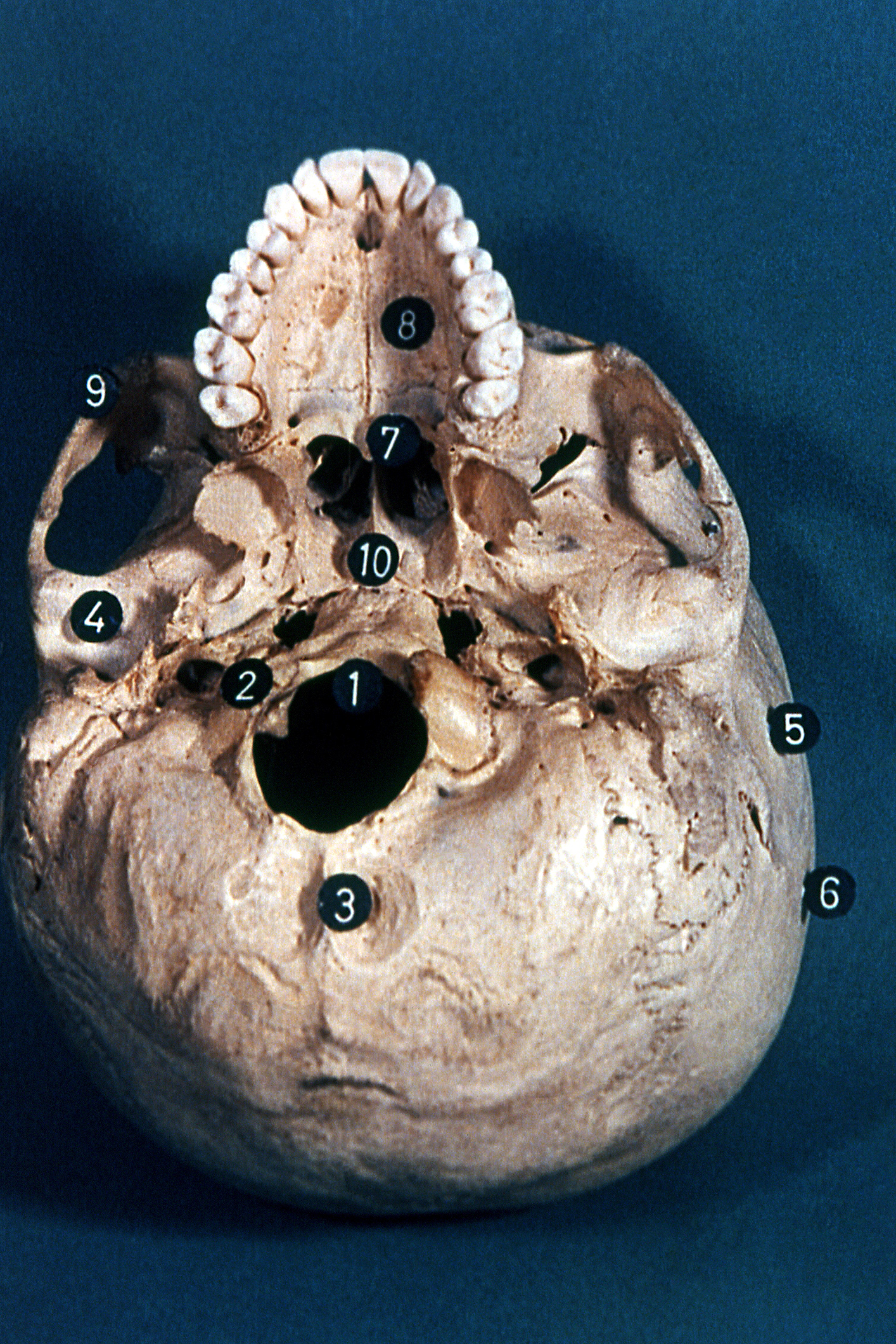 Visión inferior de la cara externa del cráneo