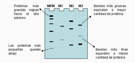 electroforesis