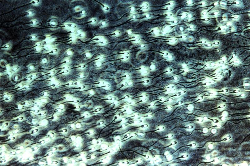 Visión microscópica de un grupo de espermatozoides