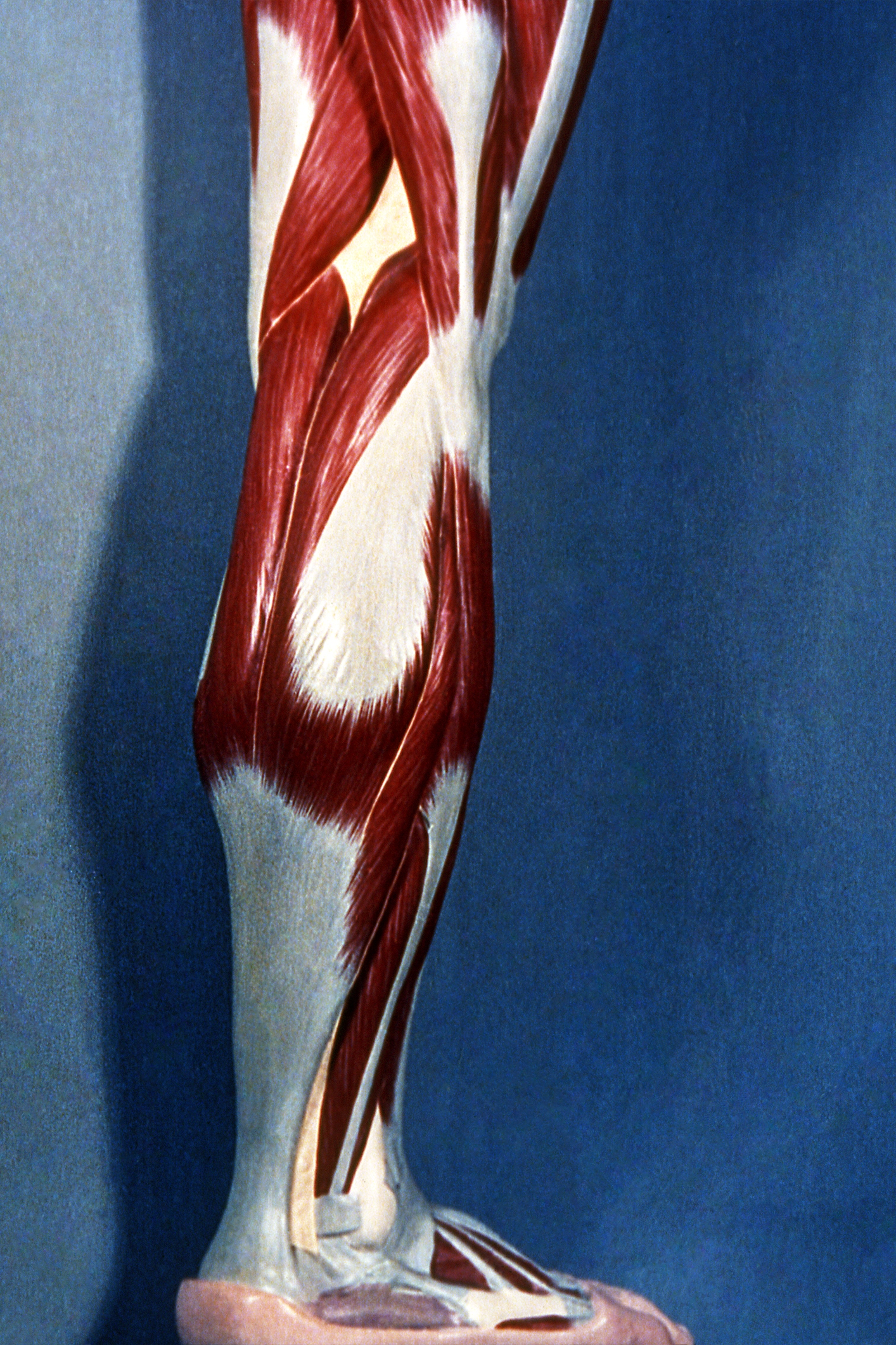 Músculo de la pierna. Visión lateral.