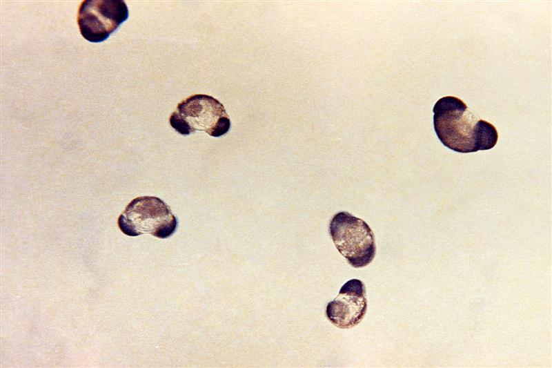 Microfotografía del polen del pino