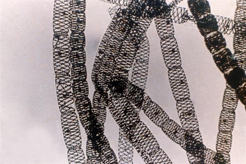 Spirogyra