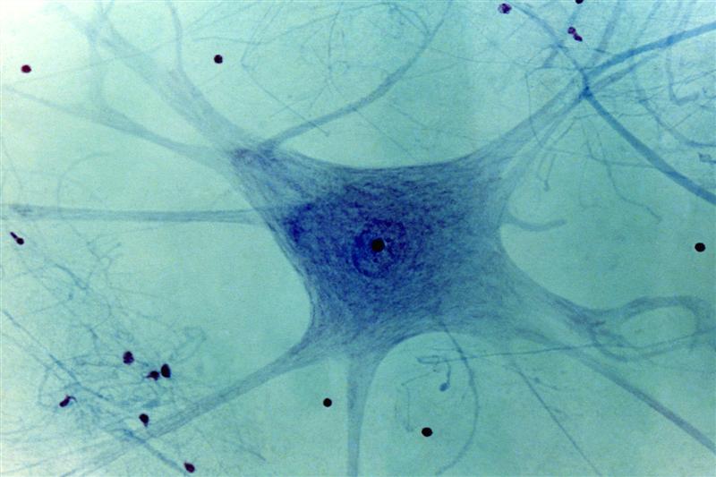Las neuronas
