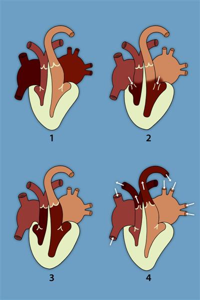 Movimientos del corazón