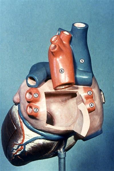 Corazón aislado