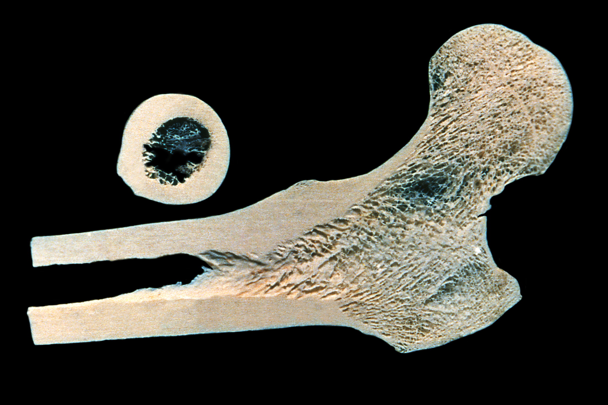 Sección del fémur