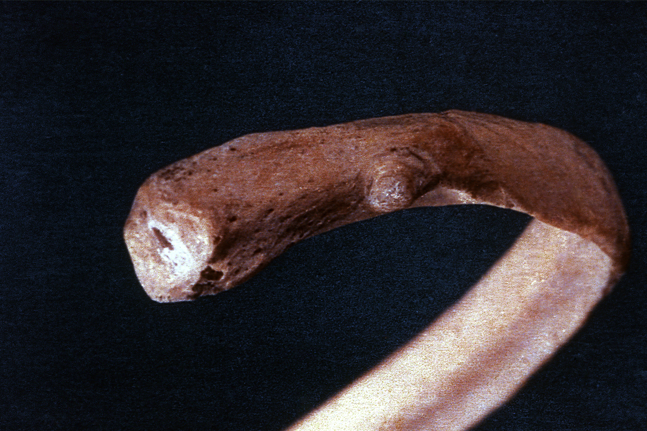 Costilla séptima