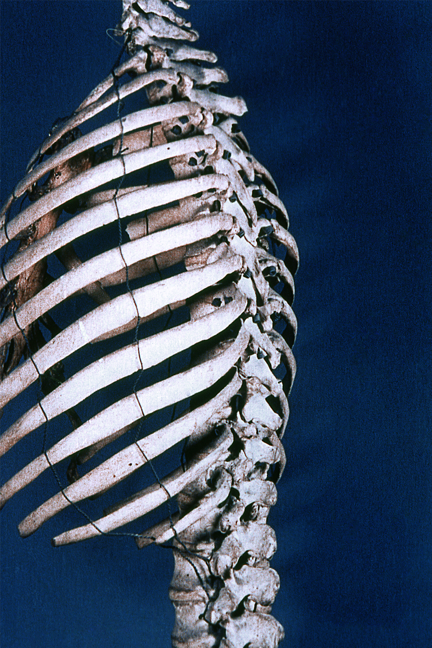 Vértebras dorsales