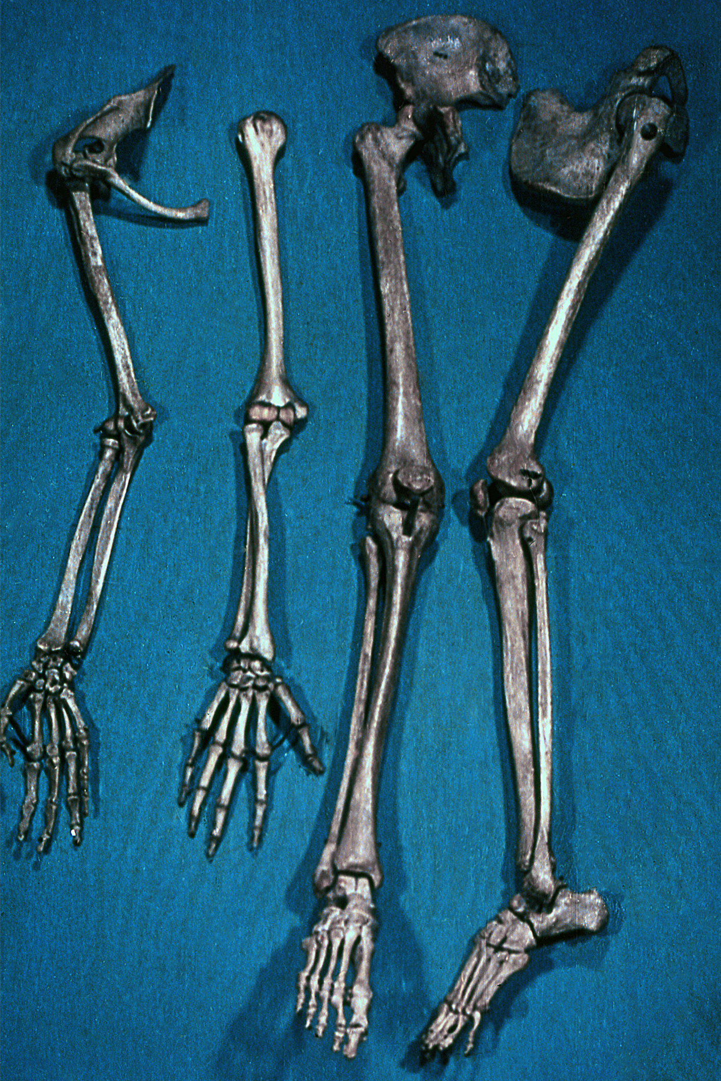 Esqueleto de las extremidades