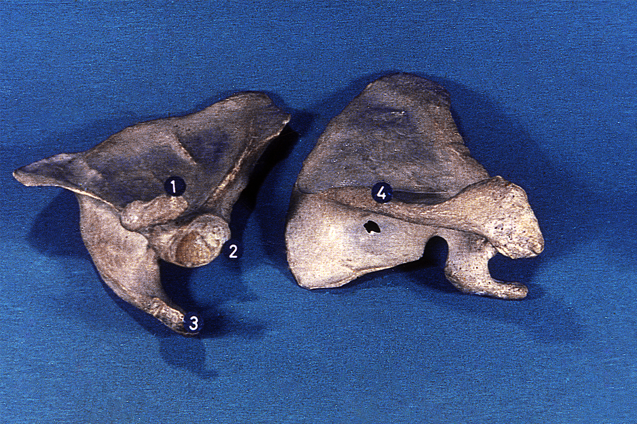 Omóplato