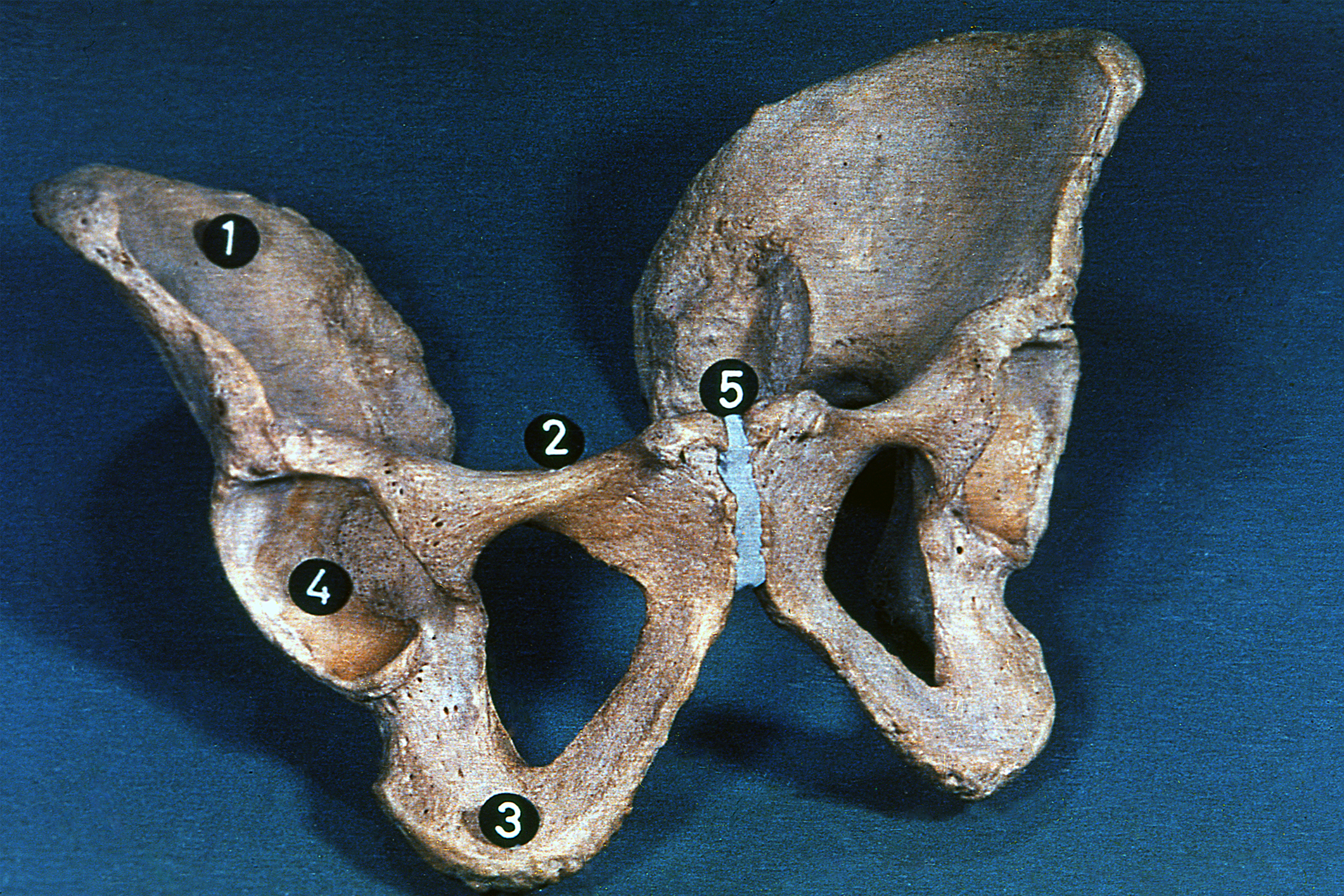Cintura pelviana