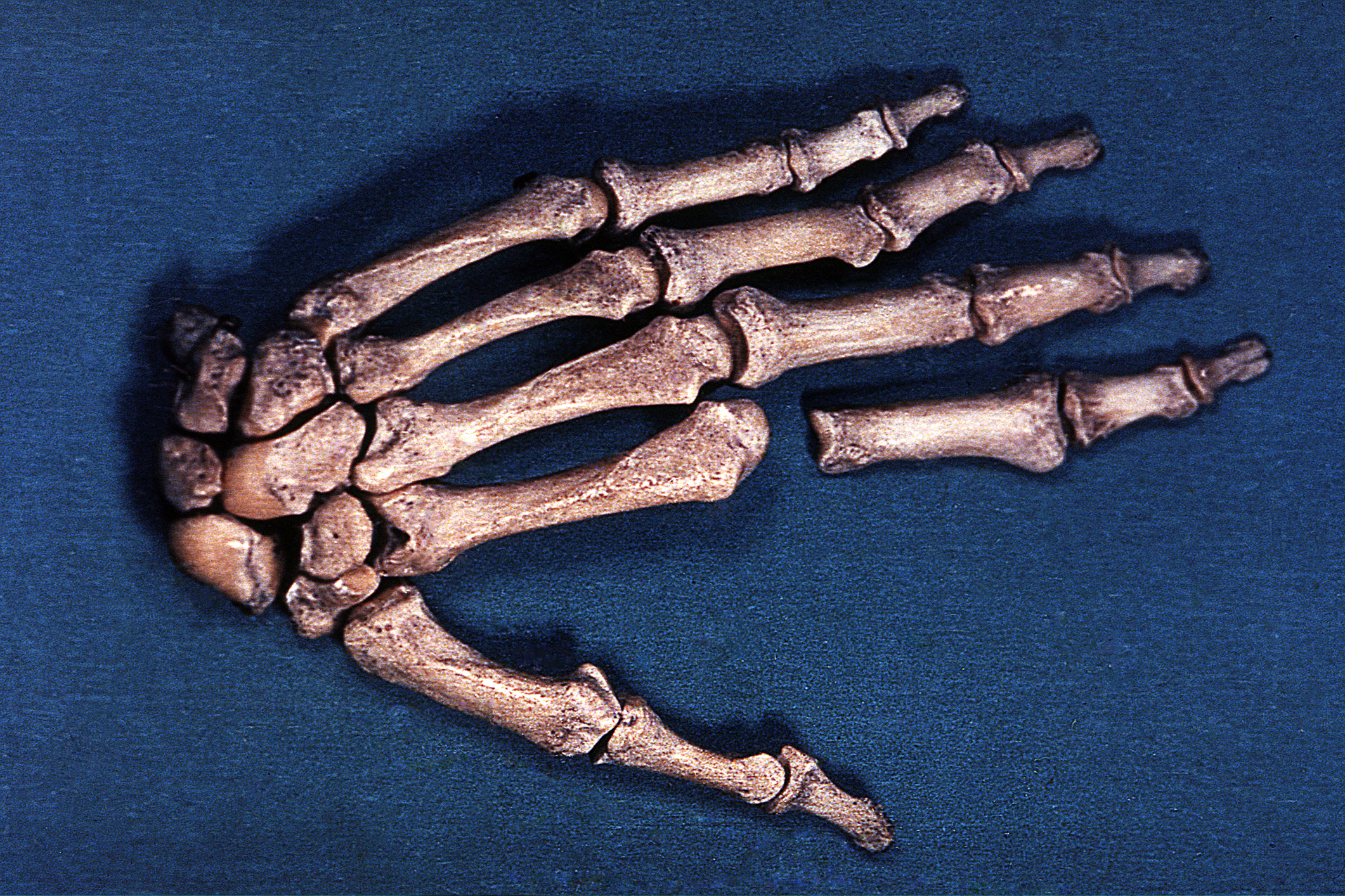 Parte de la mano izquierda