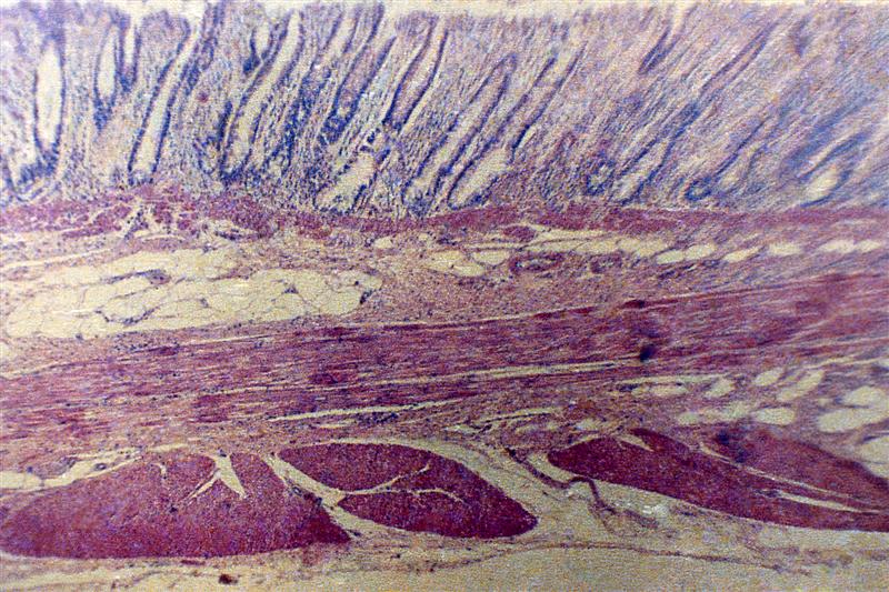 Corte transversal del intestino grueso