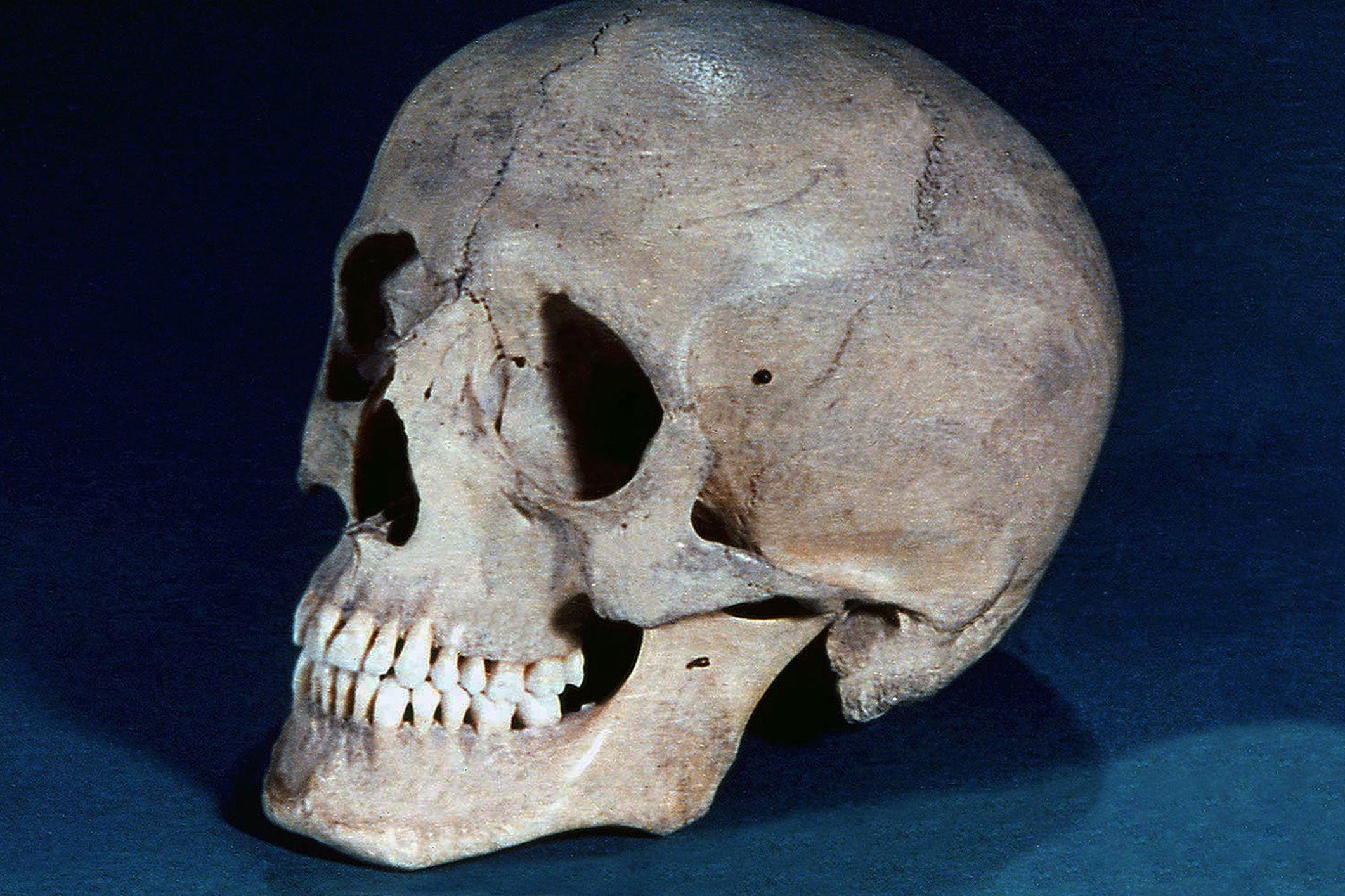 Huesos del cráneo y de la cara 