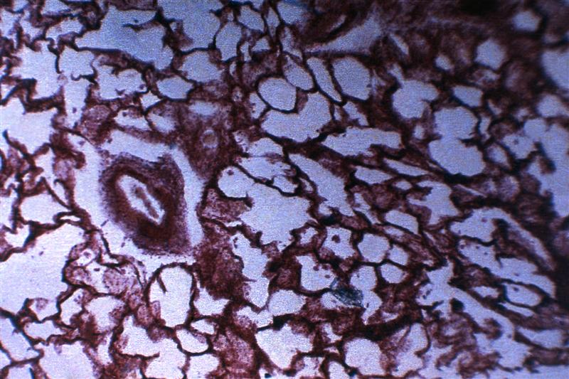 Tejido pulmonar