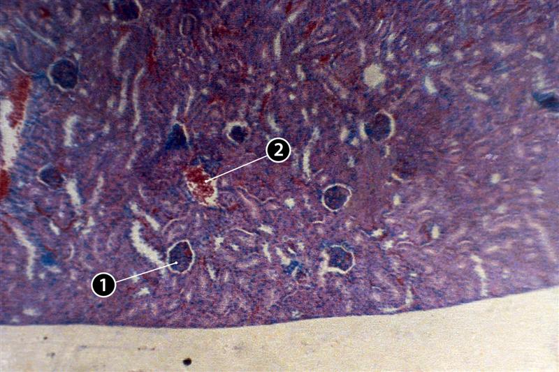 Microfotografía del riñón