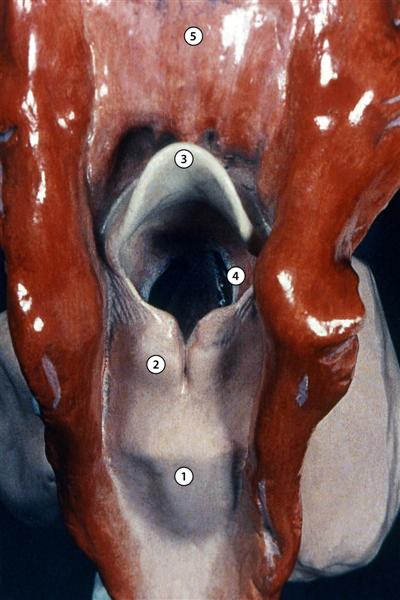 Parte posterior de la laringe